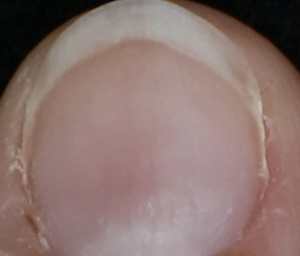 ISDIN SI-NAILS 2.5 ML