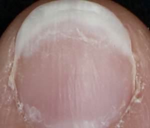 ISDIN SI-NAILS 2.5 ML